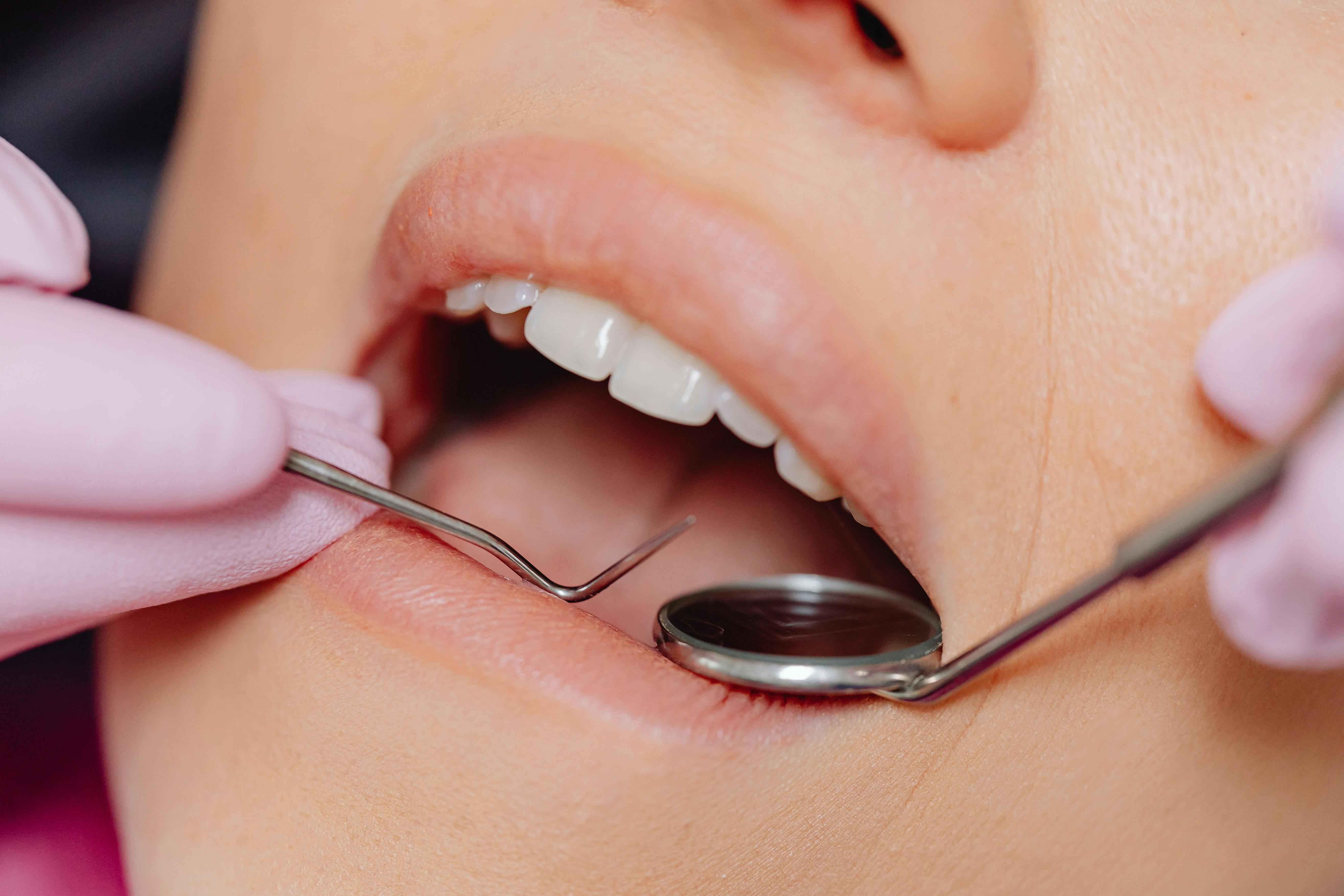 Dental Checkups